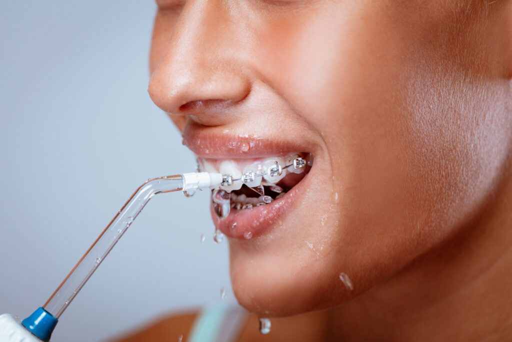 implantes dental 