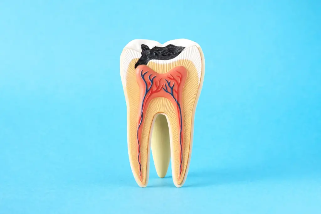 Caries en Niños diente